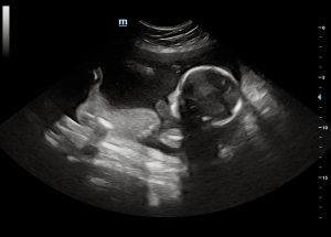 Ultrasound Northern Ireland | Baby Scans | Oh Baby